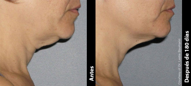 Neck_07@1x